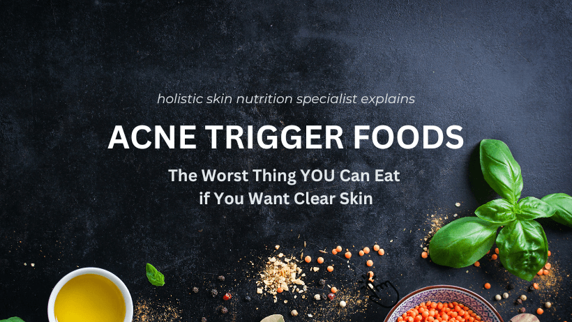 ACNE TRIGGER FOODS the Worst Thing YOU Can Eat if You Want Clear Skin